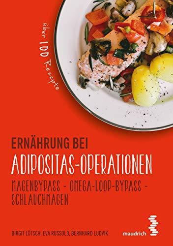 Ernährung bei Adipositas-Operationen: Magenbypass - Omega-Loop-Bypass - Schlauchmagen (maudrich.gesund essen)