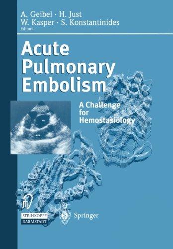 Acute Pulmonary Embolism -