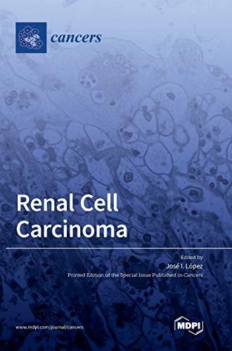 Renal Cell Carcinoma