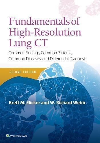 Fundamentals of High-Resolution Lung CT: Common Findings, Common Patterns, Common Diseases and Differential Diagnosis (Pocket Notebook)