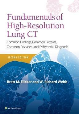 Fundamentals of High-Resolution Lung CT: Common Findings, Common Patterns, Common Diseases and Differential Diagnosis (Pocket Notebook)