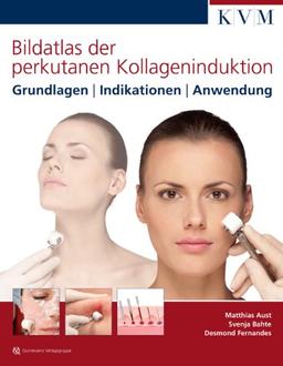 Bildatlas der perkutanen Kollageninduktion: Grundlagen | Indikationen | Anwendung