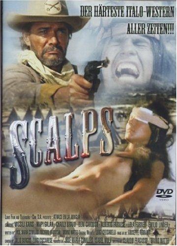 Scalps