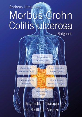 Andreas Ulmichers Morbus Crohn - Colitis ulcerosa Ratgeber: Diagnostik, Therapie - Ganzheitliche Ansätze