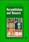 Keramikinlays und Veneers