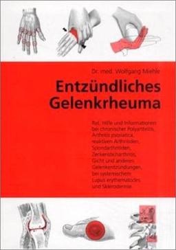 Entzündliches Gelenkrheuma