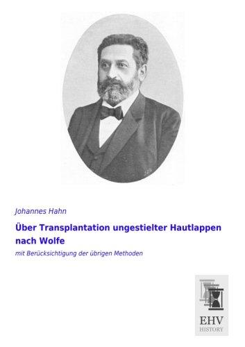 Ueber Transplantation ungestielter Hautlappen nach Wolfe: mit Beruecksichtigung der uebrigen Methoden: mit Berücksichtigung der übrigen Methoden