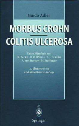 Morbus Crohn Colitis ulcerosa