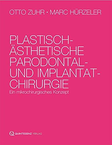 Plastisch-ästhetische Parodontal- und Implantatchirurgie: Ein mikrochirurgisches Konzept