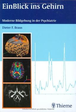 EinBlick ins Gehirn: Moderne Bildgebung in der Psychiatrie