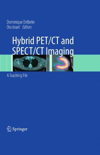 Hybrid PET/CT and SPECT/CT Imaging: A Teaching File