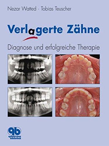 Verlagerte Zähne: Diagnose und erfolgreiche Therapie