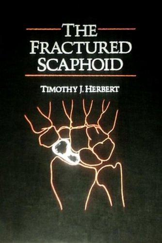 The Fractured Scaphoid