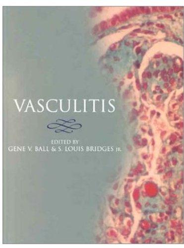 Vasculitis