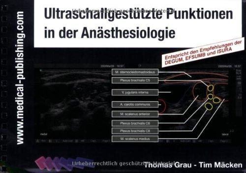 Ultraschallgestützte Punktionen in der Anästhesiologie