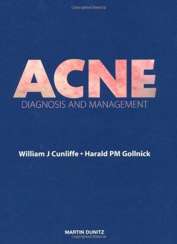 Acne: Diagnosis and Management