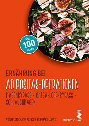 Ernährung bei Adipositas-Operationen: Magenbypass – Omega-Loop-Bypass - Schlauchmagen (maudrich.gesund essen)