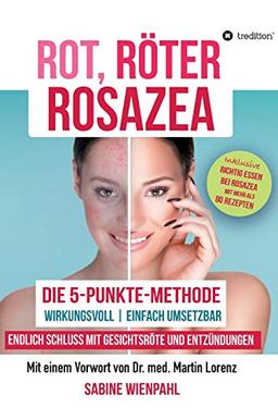 ROT RÖTER ROSAZEA: Die "5-Punkte-Methode" – Endlich Schluss mit Gesichtsröte und Entzündungen