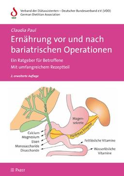 Ernährung vor und nach bariatrischen Operationen: Ein Ratgeber für Betroffene  Mit umfangreichem Rezeptteil