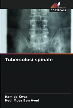 Tubercolosi spinale: DE