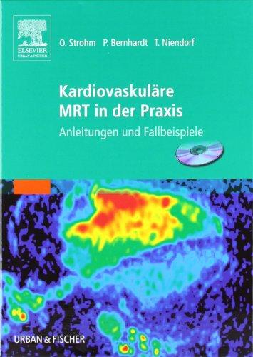 Kardiovaskuläre MRT in der Praxis: Anleitungen und Fallbeispiele