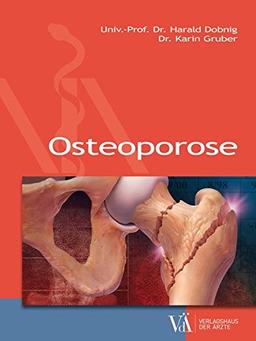 Osteoporose