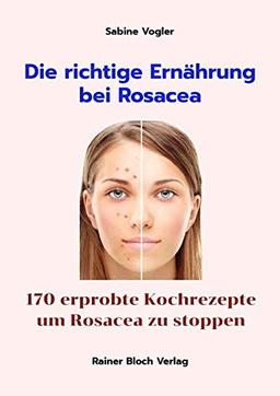 Die richtige Ernährung bei Rosacea: 170 erprobte Kochrezepte um Rosacea zu stoppen