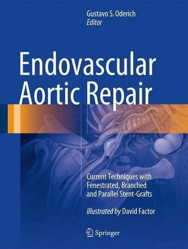 Endovascular Aortic Repair: Current Techniques with Fenestrated, Branched and Parallel Stent-Grafts