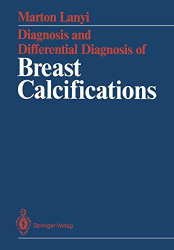 Diagnosis and Differential Diagnosis of Breast Calcifications