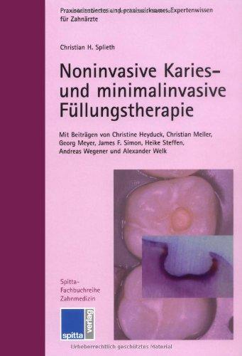 Noninvasive Karies- und minimalinvasive Füllungstherapie