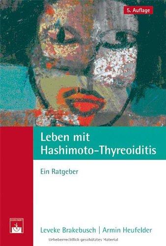 Leben mit Hashimoto-Thyreoiditis: Ein Ratgeber