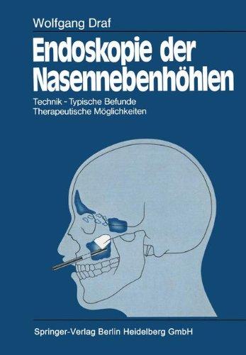 Endoskopie der Nasennebenhöhlen: Technik · Typische Befunde, Therapeutische Möglichkeiten (German Edition)