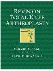 Revision Total Knee Arthroplasty