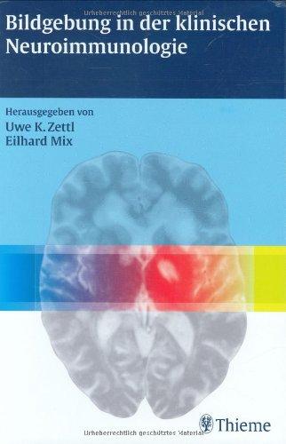 Bildgebung in der klinischen Neuroimmunologie