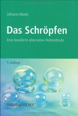 Das Schröpfen: Eine bewährte alternative Heilmethode