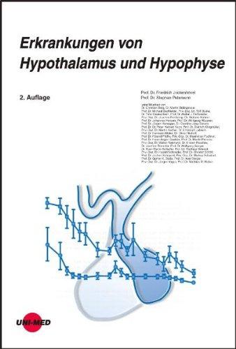 Erkrankungen von Hypothalamus und Hypophyse