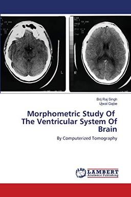 Morphometric Study Of The Ventricular System Of Brain: By Computerized Tomography