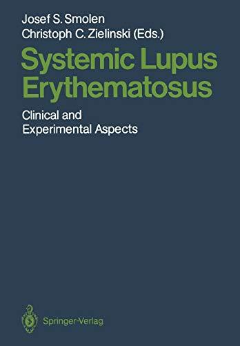 Systemic Lupus Erythematosus: Clinical and Experimental Aspects