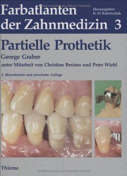 Farbatlanten der Zahnmedizin, Bd.3, Partielle Prothetik