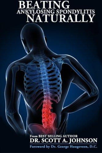 Beating Ankylosing Spondylitis Naturally