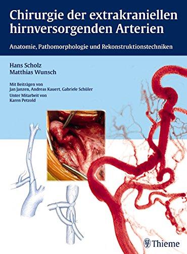 Chirurgie der extrakraniellen hirnversorgenden Arterien: Anatomie, Pathomorphologie und Rekonstruktionstechniken