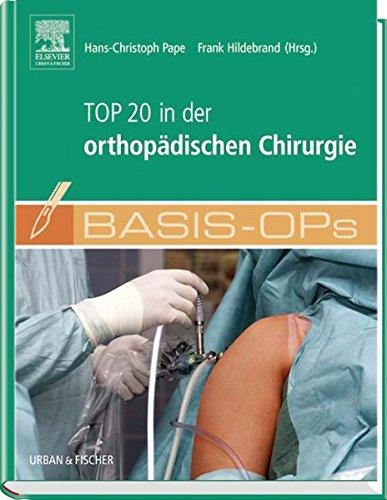 Basis OPs - Top 20 in der orthopädischen Chirurgie