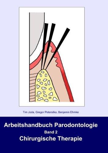 Arbeitshandbuch Parodontologie: Band 2: Chirurgische Therapie