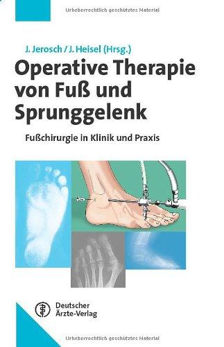 Operative Therapie von Fuß und Sprunggelenk: Fußchirurgie in Klinik und Praxis