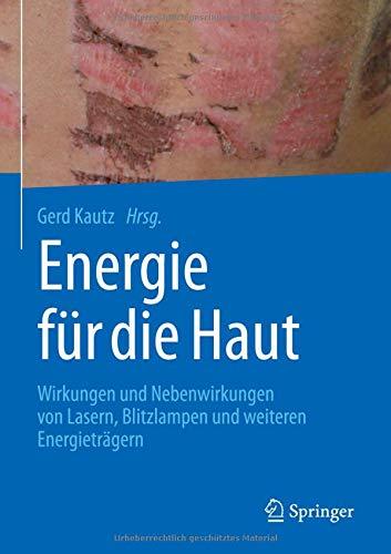 Energie für die Haut: Wirkungen und Nebenwirkungen von Lasern, Blitzlampen und weiteren Energieträgern