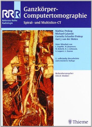 Ganzkörper-Computertomographie: Spiral- und Multislice-CT