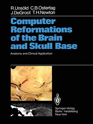 Computer Reformations of the Brain and Skull Base: Anatomy and Clinical Application