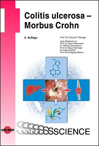 Colitis ulcerosa - Morbus Crohn (UNI-MED Science)