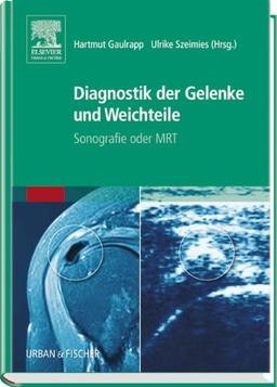 Diagnostik der Gelenke und Weichteile: Sonografie oder MRT