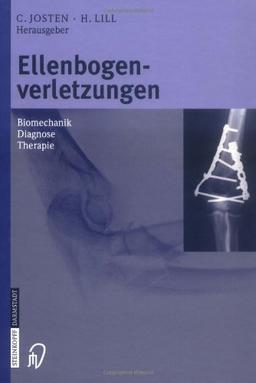 Ellenbogenverletzungen. Biomechanik - Diagnose - Therapie